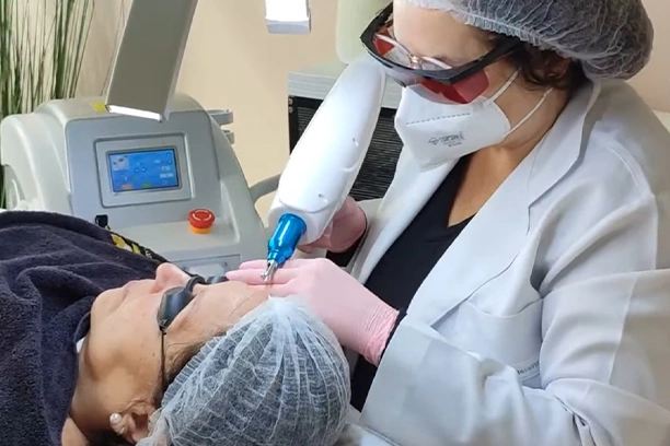 Borrado de Microblading - Eliminación de Tatuajes