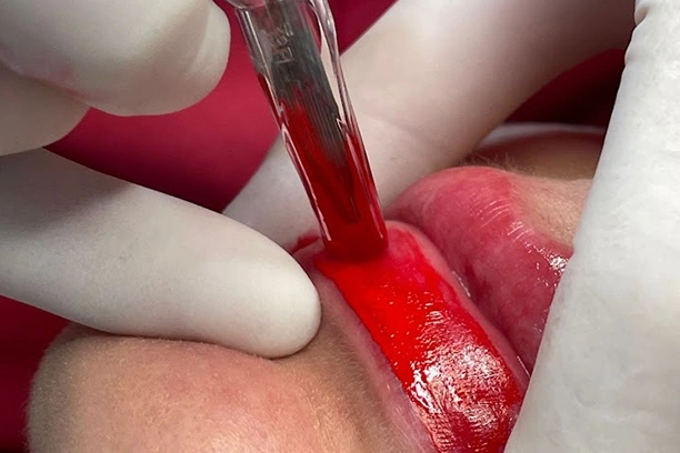 Micropigmentación de Labios