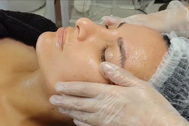 Rejuvenecimiento Facial